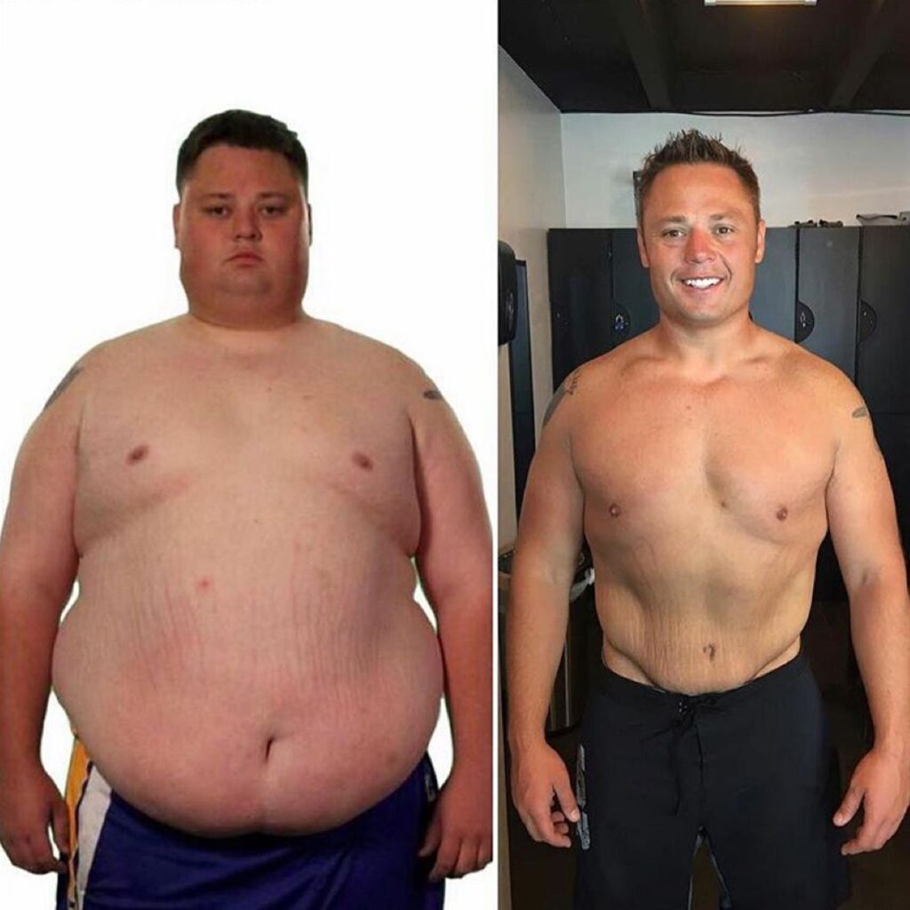 What Happened To Wally From Extreme Weight Loss